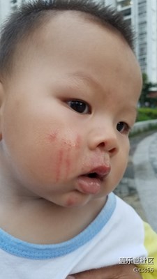 可憐的娃，爺爺沒看住摔了